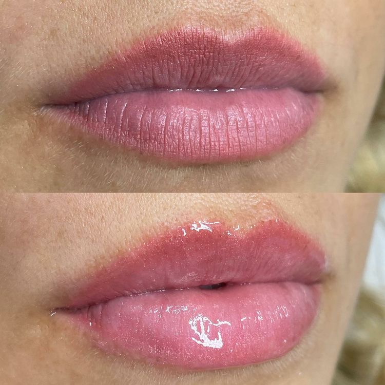 Foto Hidra Gloss 1