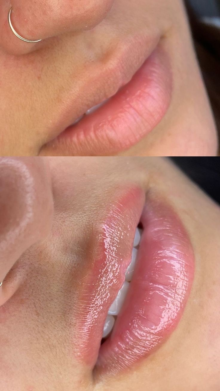 Foto Hidra Gloss 4