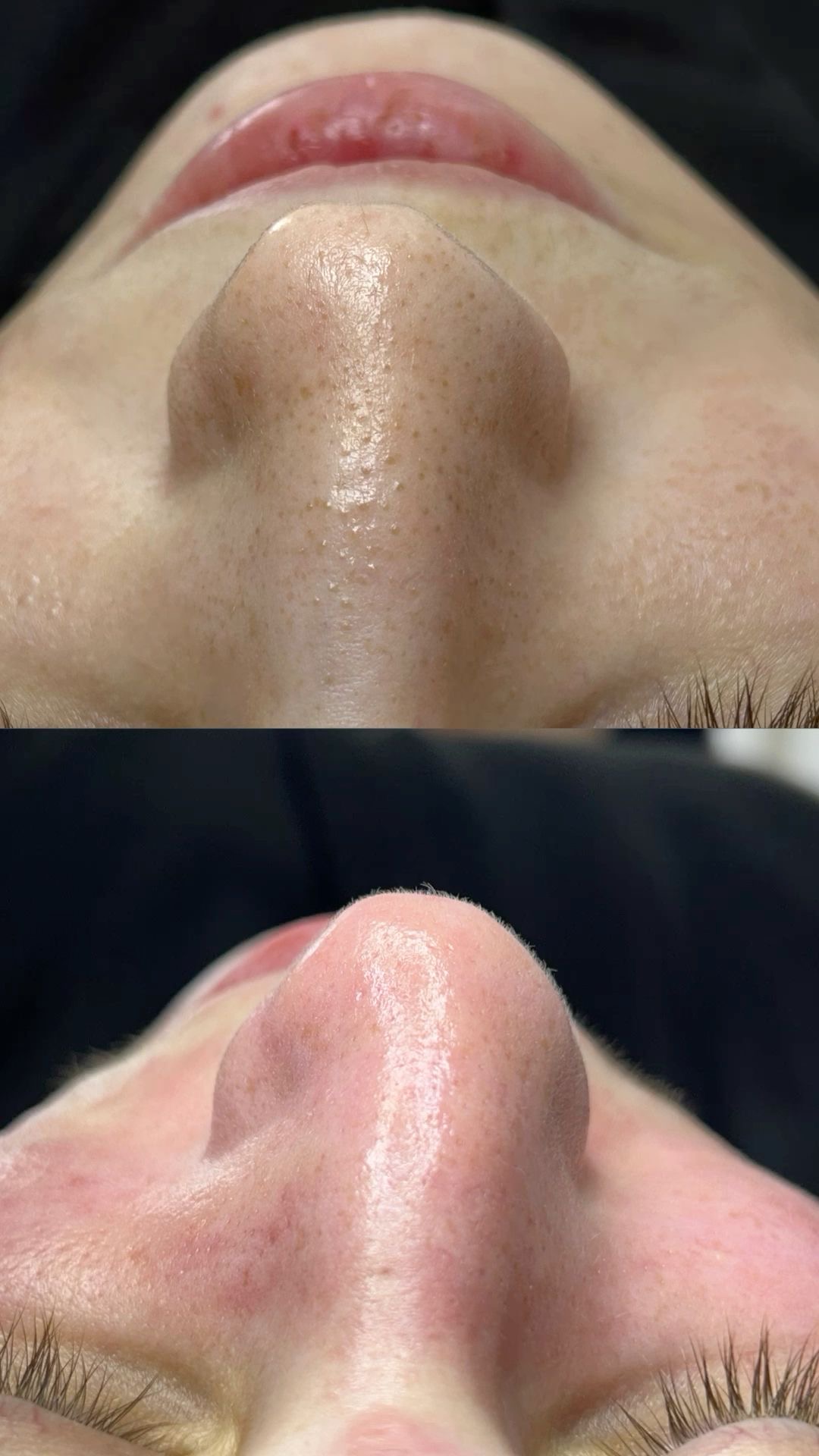 Limpeza de Pele 1