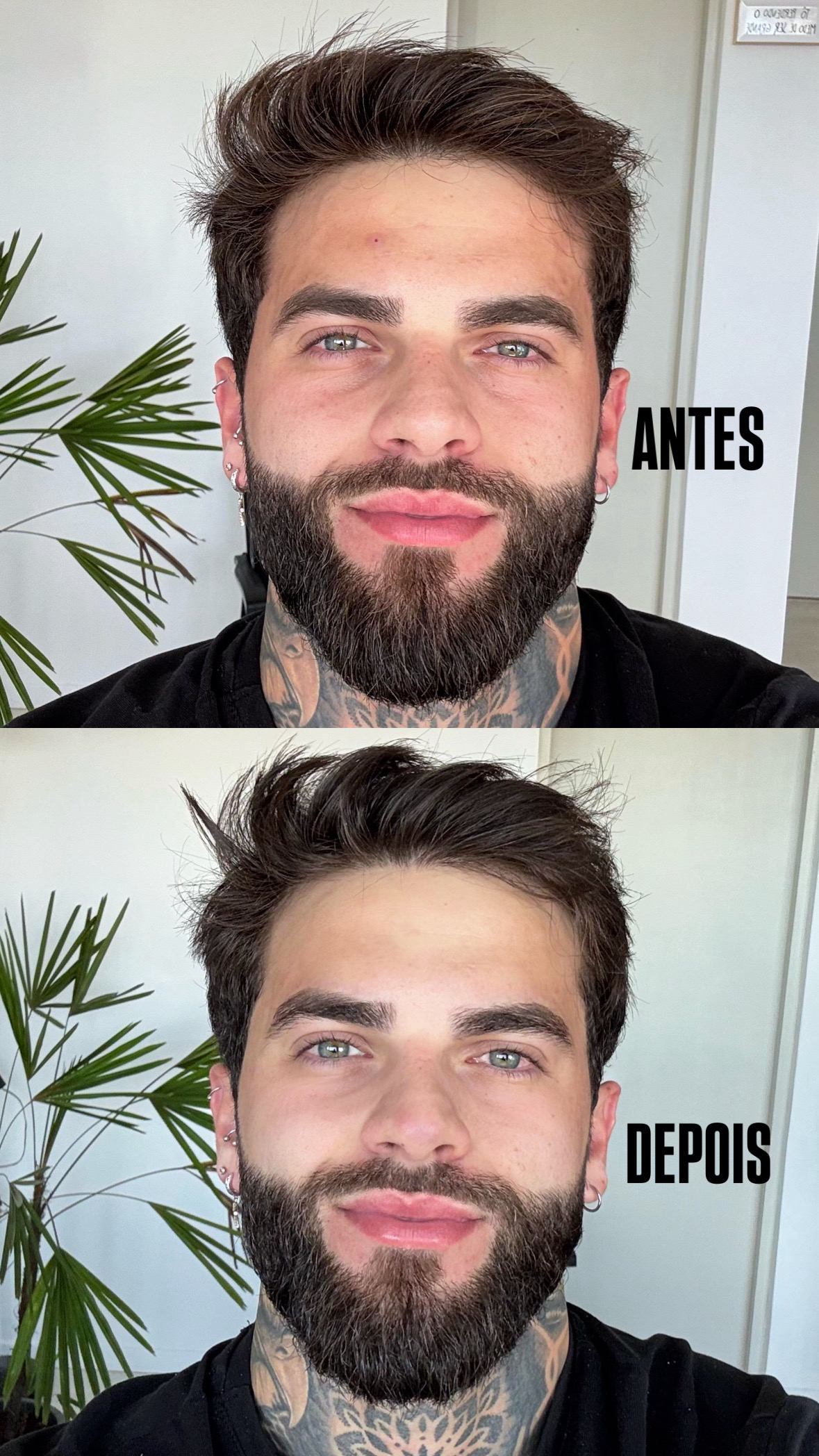 Limpeza de Pele 5